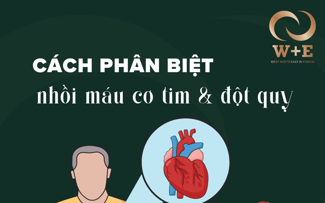 Nhồi máu cơ tim khác gì đột quỵ?